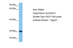 SLC25A10 Rabbit anti-Human, Polyclonal, Novus Biologicals 0.1 mL | Buy Online | Novus Biologicals | Fisher Scientific